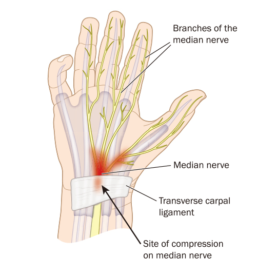 median-nerve