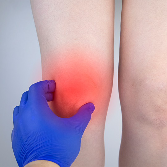 woman-suffers-from-knee